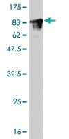 Anti-FYN Mouse Monoclonal Antibody [clone: 3G11-F9]