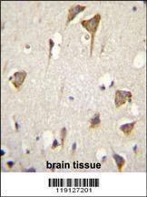 Anti-MYO6 Rabbit Polyclonal Antibody (FITC (Fluorescein Isothiocyanate))