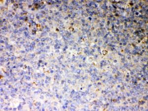 Anti-JAK2 Rabbit Polyclonal Antibody