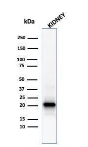 Western blot analysis of human kidney tissue lysate using Anti-Ferritin Light Chain Antibody [FTL/1386]