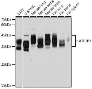 Western blot analysis of extracts of various cell lines, using Anti-ATP1B3 Antibody [ARC2205] (A306065) at 1:1,000 dilution