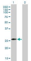 Anti-ZNF266 Rabbit Polyclonal Antibody