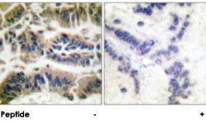 Anti-CASP6 Rabbit Polyclonal Antibody