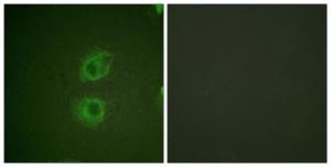 Immunofluorescence analysis of HUVEC cells using Anti-HER3 Antibody. The right hand panel represents a negative control, where the Antibody was pre-incubated with the immunising peptide