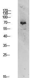 Antibody anti-TIF-IA 100 µg