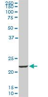 Anti-EFHD1 Mouse Monoclonal Antibody [clone: 1A8]