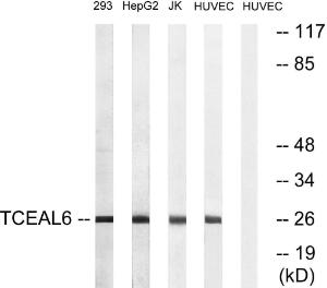 Western blot analysis of lysates from HUVEC, 293, HepG and Jurkat cells using Anti-TCEAL6 Antibody. The right hand lane represents a negative control, where the antibody is blocked by the immunising peptide.