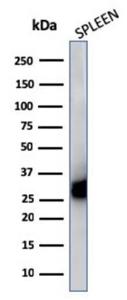 Western blot analysis of human spleen cell lysate using Anti-HLA DP + DQ + DR Antibody [CR3/43]