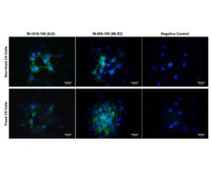 Membrane p75NTR expression in rat C6 cells.  Magnification: 100x.