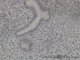 Anti-NEK11 Mouse Monoclonal Antibody [clone: 4E1-1F4]