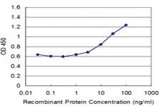 Anti-TNNT1 Mouse Monoclonal Antibody [clone: 4G6]