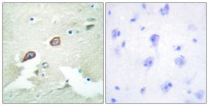 Immunohistochemical analysis of paraffin-embedded human brain tissue using Anti-HER3 Antibody. The right hand panel represents a negative control, where the Antibody was pre-incubated with the immunising peptide