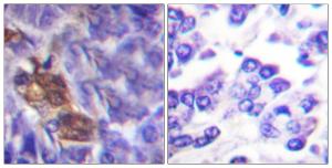 Anti-MSK1 antibody