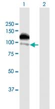 Anti-ZFYVE16 Rabbit Polyclonal Antibody