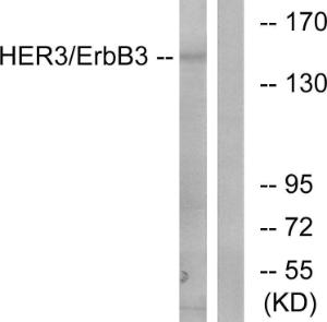 Western blot analysis of lysates from 293 cells using Anti-HER3 Antibody. The right hand lane represents a negative control, where the Antibody is blocked by the immunising peptide