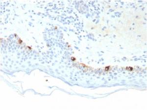 Immunohistochemical analysis of formalin-fixed, paraffin-embedded human skin using Anti-TRP1 Antibody [TYRP1/3281]