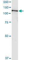 Anti-ZFYVE16 Rabbit Polyclonal Antibody