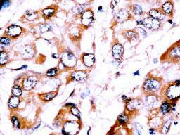 Anti-PRF-1 Rabbit Polyclonal Antibody (Biotin)