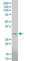 Anti-DLX1 Mouse Monoclonal Antibody [clone: 4B7]