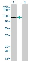 Anti-ZFYVE16 Mouse Monoclonal Antibody [clone: 4B9]