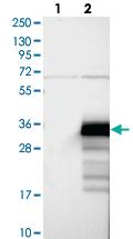 Anti-ZCCHC24 Rabbit Polyclonal Antibody