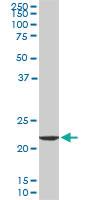 Anti-EFHD1 Mouse Monoclonal Antibody [clone: 1A8]