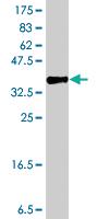 Anti-CLP1 Mouse Polyclonal Antibody