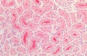 Immunohistochemistry analysis of human kidney, fixed in formalin and paraffin-embedded. The Primary Antibody used was Anti-Tau Antibody (A304913).