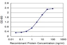 Anti-ZFYVE16 Mouse Monoclonal Antibody [clone: 4B9]