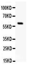 Anti-Somatostatin Receptor 1 Rabbit Polyclonal Antibody