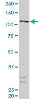 Anti-ZFYVE16 Mouse Monoclonal Antibody [clone: 2E2]