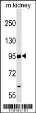 Anti-NCAM2 Rabbit Polyclonal Antibody (AP (Alkaline Phosphatase))