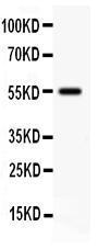 Anti-Somatostatin Receptor 2 Rabbit Polyclonal Antibody