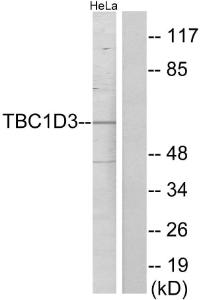 Western blot analysis of lysates from HeLa cells using Anti-TBC1D3 Antibody. The right hand lane represents a negative control, where the Antibody is blocked by the immunising peptide