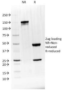 SDS-PAGE analysis of Anti-BTLA Antibody [BTLA/1528] under non-reduced and reduced conditions; showing intact IgG and intact heavy and light chains, respectively. SDS-PAGE analysis confirms the integrity and purity of the antibody.