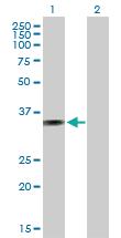 Anti-AMMECR1 Mouse Polyclonal Antibody