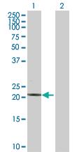 Anti-TNNT2 Rabbit Polyclonal Antibody