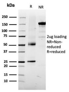 SDS-PAGE analysis of Anti-TRP1 Antibody [TYRP1/3281] under non-reduced and reduced conditions; showing intact IgG and intact heavy and light chains, respectively SDS-PAGE analysis confirms the integrity and purity of the antibody