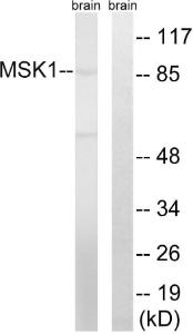 Western blot analysis of lysates from mouse brain using Anti-MSK1 Antibody. The right hand lane represents a negative control, where the antibody is blocked by the immunising peptide.