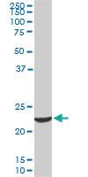 Anti-EFHD1 Mouse Monoclonal Antibody [clone: 1A8]