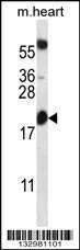 Anti-BCL2 Rabbit Polyclonal Antibody (Biotin)