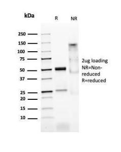 SDS-PAGE analysis of Anti-MyoD1 Antibody [MYOD1/2075R] under non-reduced and reduced conditions; showing intact IgG and intact heavy and light chains, respectively. SDS-PAGE analysis confirms the integrity and purity of the antibody