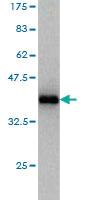 Anti-CLP1 Mouse Monoclonal Antibody [clone: 8D5]