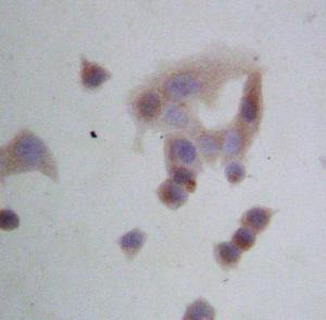 Anti-GRP94 Rabbit Polyclonal Antibody