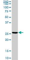 Anti-TNNT2 Rabbit Polyclonal Antibody