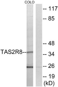 Western blot analysis of lysates from COLO cells using Anti-TAS2R8 Antibody The right hand lane represents a negative control, where the antibody is blocked by the immunising peptide