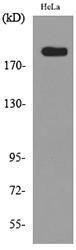 Anti-MRC2 antibody