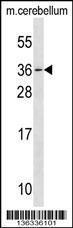 Anti-MESP1 Rabbit Polyclonal Antibody (Biotin)