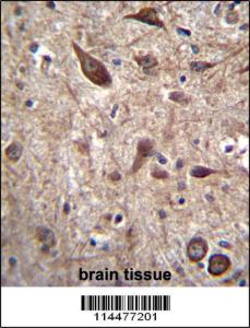 Anti-PTN Rabbit Polyclonal Antibody (APC (Allophycocyanin))