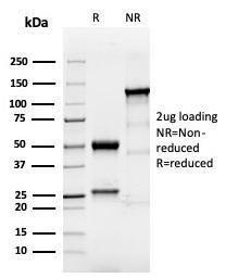 SDS-PAGE analysis of Anti-TROP2 Antibody [TACSTD2/6394R] under non-reduced and reduced conditions; showing intact IgG and intact heavy and light chains, respectively. SDS-PAGE analysis confirms the integrity and purity of the antibody.